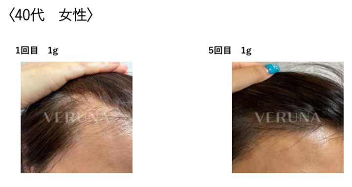 施術事例