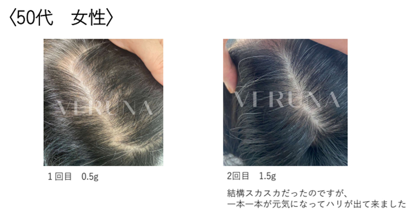 施術事例